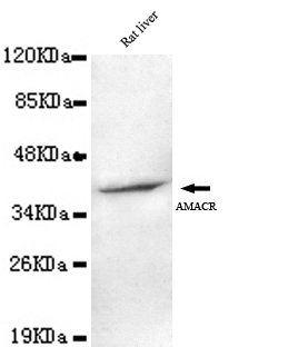 Anti-AMACR (C-term) Antibody