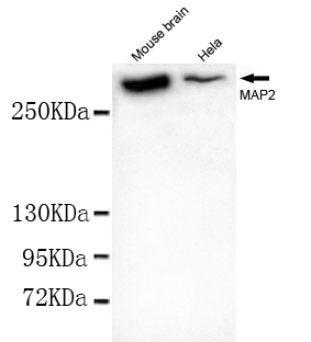 Anti-MAP2 (N-term) Antibody