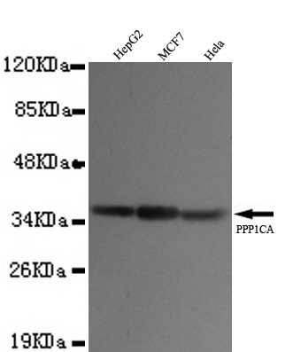 Anti-PP1A (N-term) Antibody