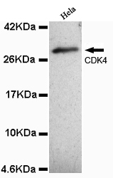 Anti-CDK4 (N-term) Antibody
