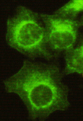 Anti-CDK4 (N-term) Antibody Anti-CDK4 (N-term) Antibody