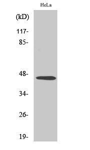 Anti-Inhibin beta-B Antibody