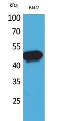 Anti-Kallistatin Antibody