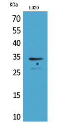 Anti-Osteoglycin Antibody