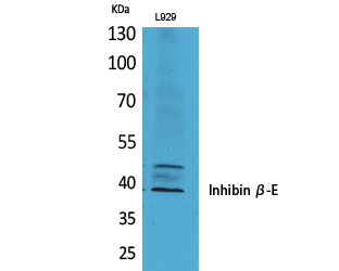 Anti-Inhibin beta-E Antibody