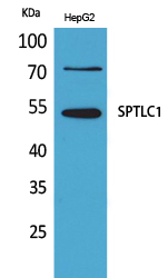 Anti-SPTLC1 Antibody