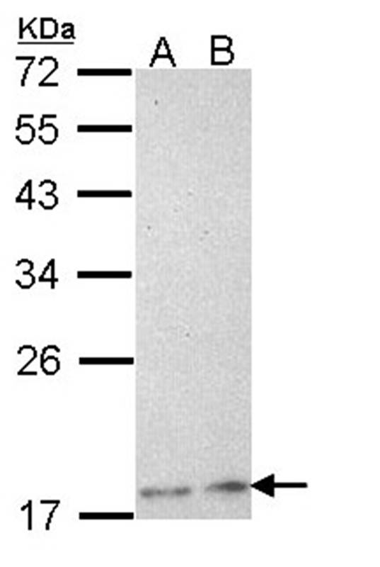 Anti-Phospholipase A2 XIIA Antibody