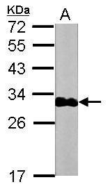 Anti-Troponin I (cardiac) Antibody