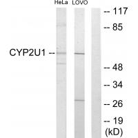 Anti-Cytochrome P450 2U1 Antibody