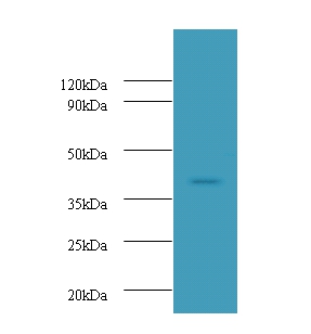 Anti-Ubiquitin-conjugating enzyme E2 Q2 Antibody