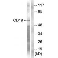 Anti-CD19 (Ab-531) Antibody