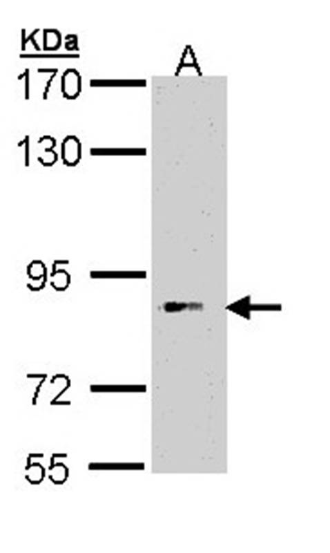 Anti-FLJ35630 Antibody