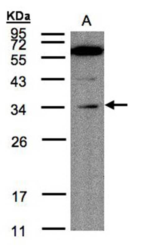 Anti-Malectin Antibody