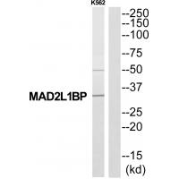 Anti-MAD2L1BP Antibody