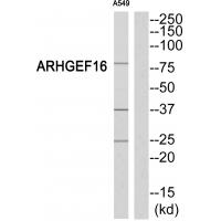 Anti-ARHGEF16 Antibody