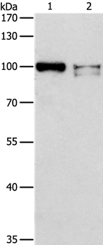 Anti-ADAMTSL2 Antibody