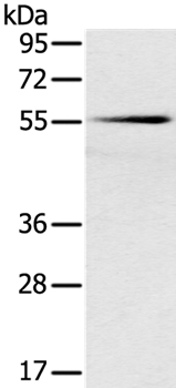 Anti-SLC16A10 Antibody