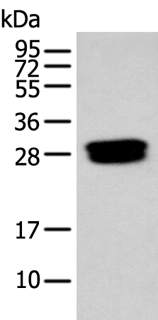 Anti-GLIPR1L1 Antibody
