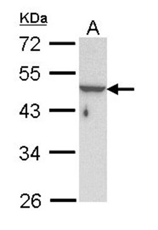 Anti-KRTHA3B Antibody