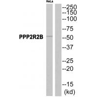 Anti-PPP2R2B Antibody