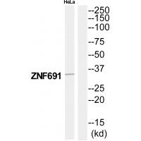 Anti-ZNF691 Antibody