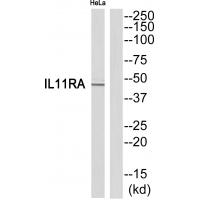Anti-IL11RA Antibody