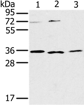 Anti-IL22RA2 Antibody