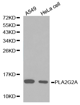 Anti-PLA2G2A Antibody