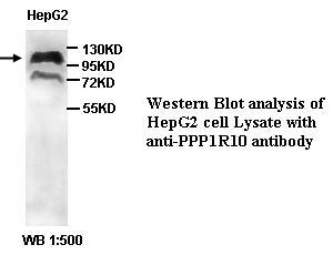 Anti-PPP1R10 Antibody