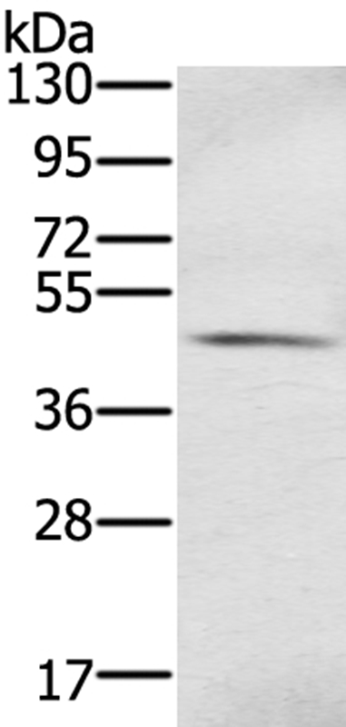 Anti-S100PBP Antibody