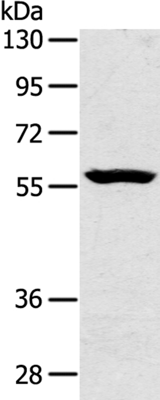 Anti-SLC39A5 Antibody