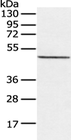 Anti-CXorf36 Antibody