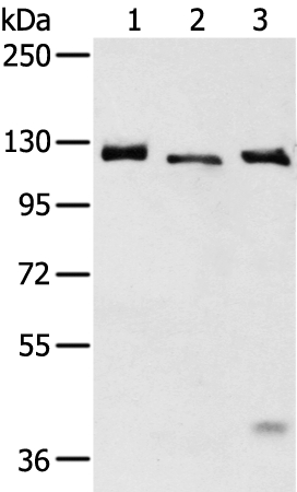 Anti-SLC4A3 Antibody