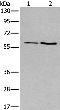 Anti-SLC17A8 Antibody