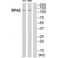 Anti-POLR1B Antibody