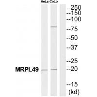 Anti-MRPL49 Antibody
