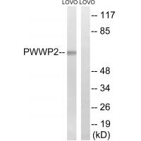 Anti-PWWP2B Antibody