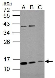 Anti-ROPN1B Antibody