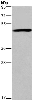 Anti-FOXD1 Antibody