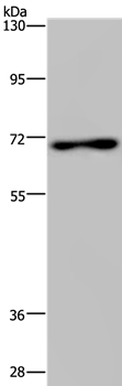 Anti-TIPARP Antibody