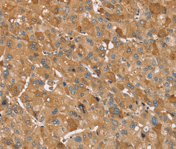 Anti-TRIM34 Antibody Anti-TRIM34 Antibody