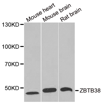 Anti-ZBTB38 Antibody