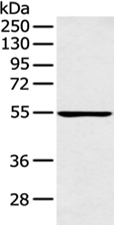 Anti-PFKFB4 Antibody