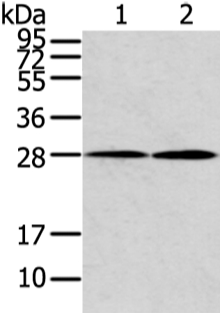 Anti-KCNMB1 Antibody