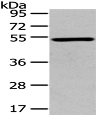 Anti-TSPYL1 Antibody