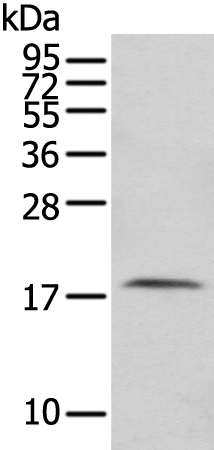 Anti-FAM96A Antibody