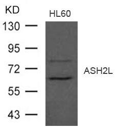 Anti-ASH2L Antibody