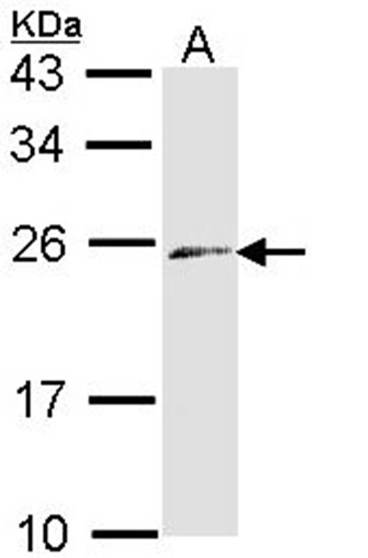 Anti-ET-3 Antibody