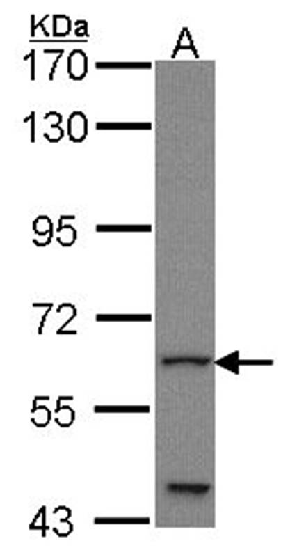 Anti-GLIS1 Antibody