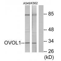 Anti-OVOL1 Antibody
